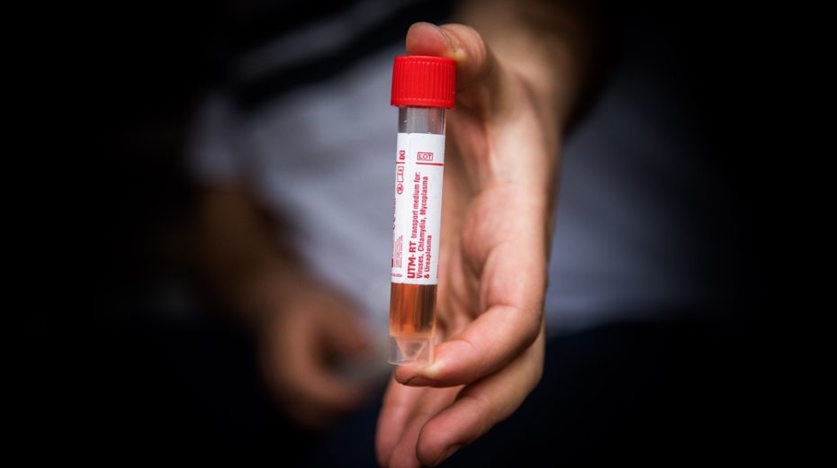 Mossad Secretly Acquires 100,000 Coronavirus Test Kits for Israel Israel's Mossad got its hands on 100,000 coronavirus test kits