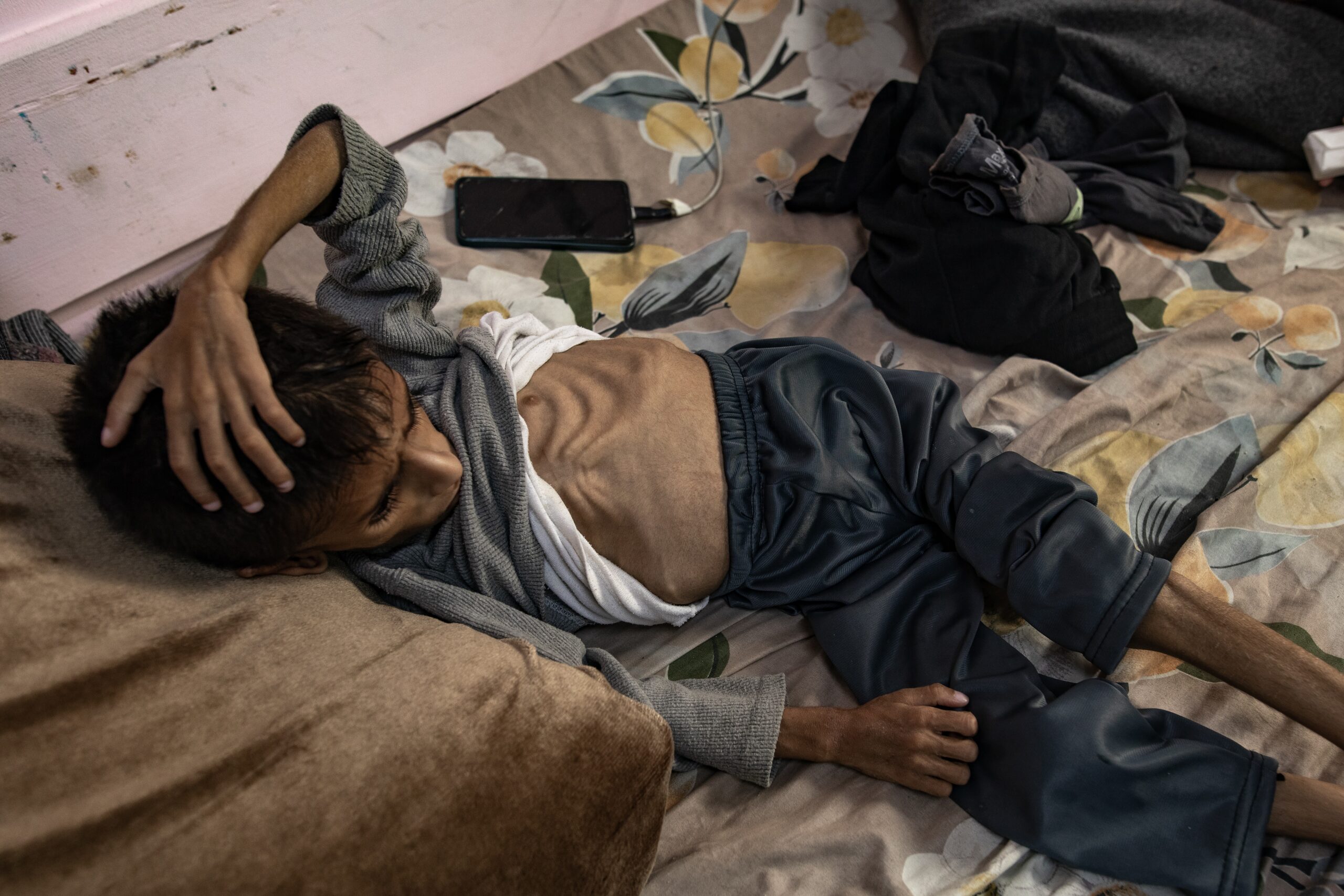 Five-year-old Palestinian boy Osama al-Raqab at Nasser Hospital in Khan Yunis, southern Gaza Strip. He suffers from cystic fibrosis, not malnutrition. Photo: EPA/HAITHAM IMAD